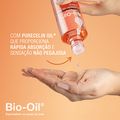 Tratamento Antiestrias Bio-Oil