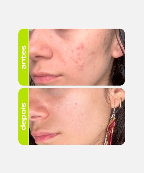 tônico facial creamy clareador ácido tranexâmico 90ml