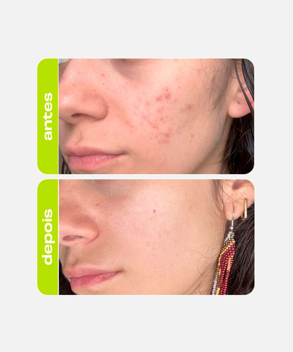 tônico facial creamy clareador ácido tranexâmico 90ml