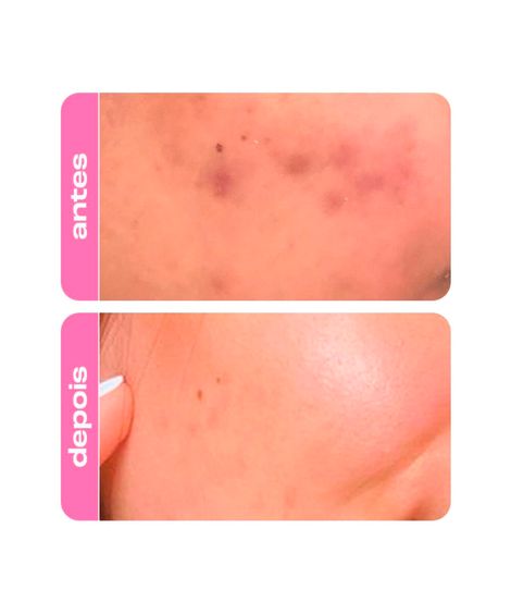 sérum facial creamy niacinamide b complex 30ml