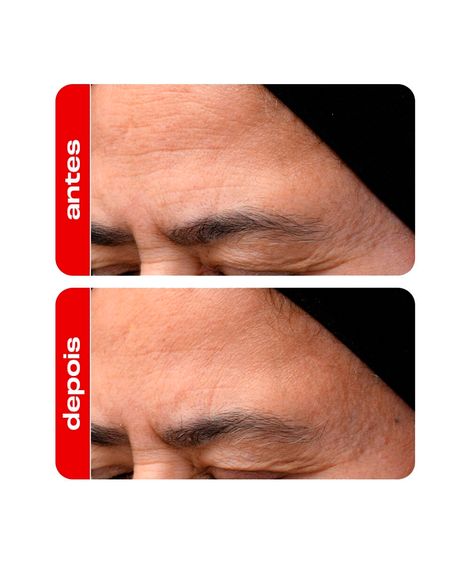 sérum facial creamy anti idade retinal 30g