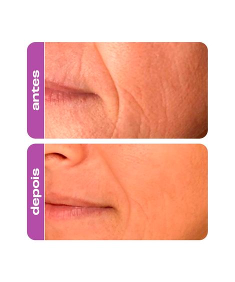creme em gel facial creamy  30g