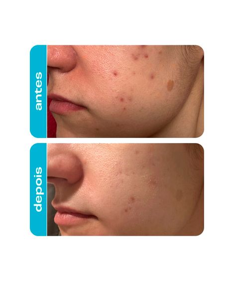 hidratante facial creamy ácido glicólico 30g